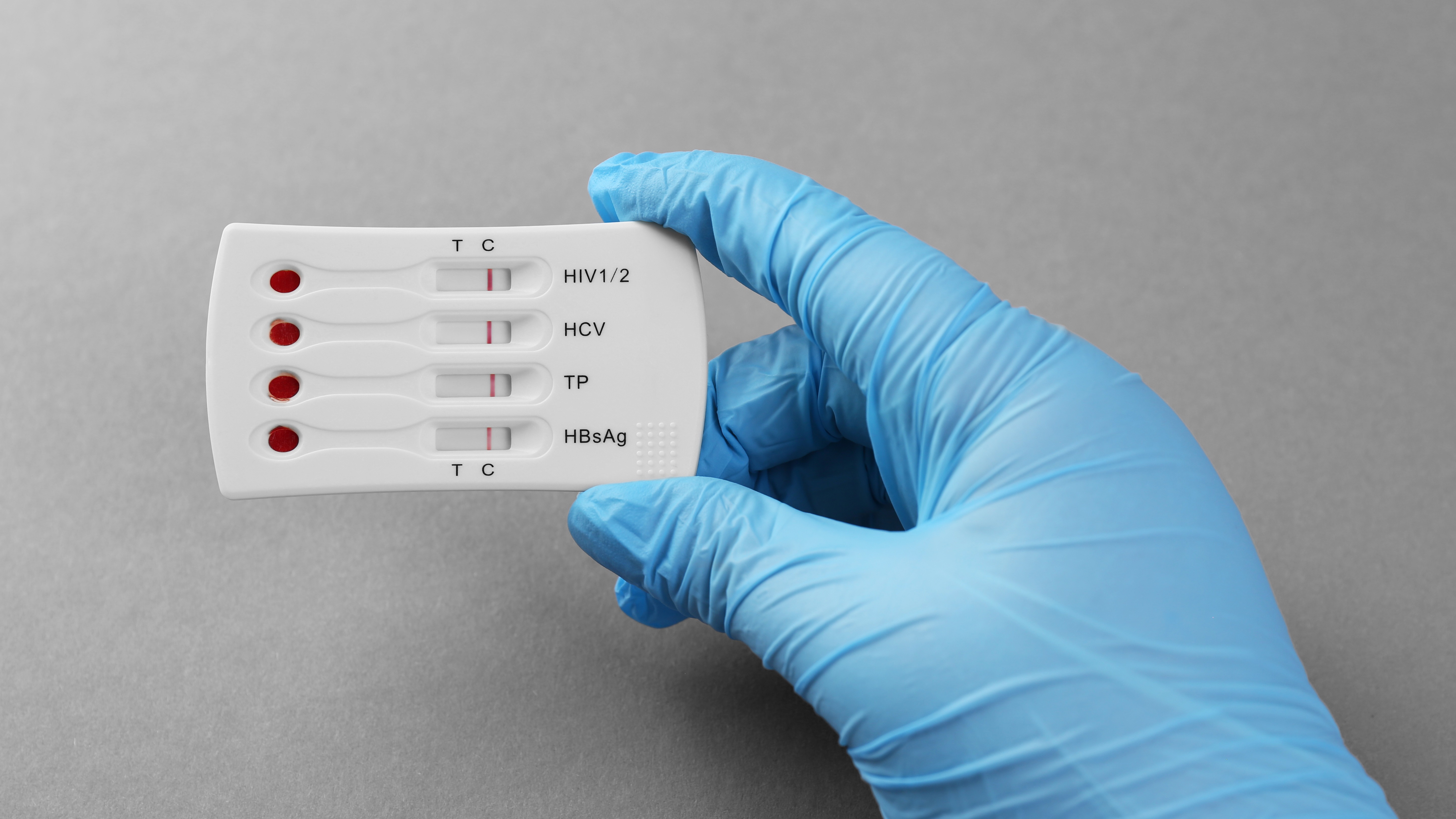 Switch your certification to DNV